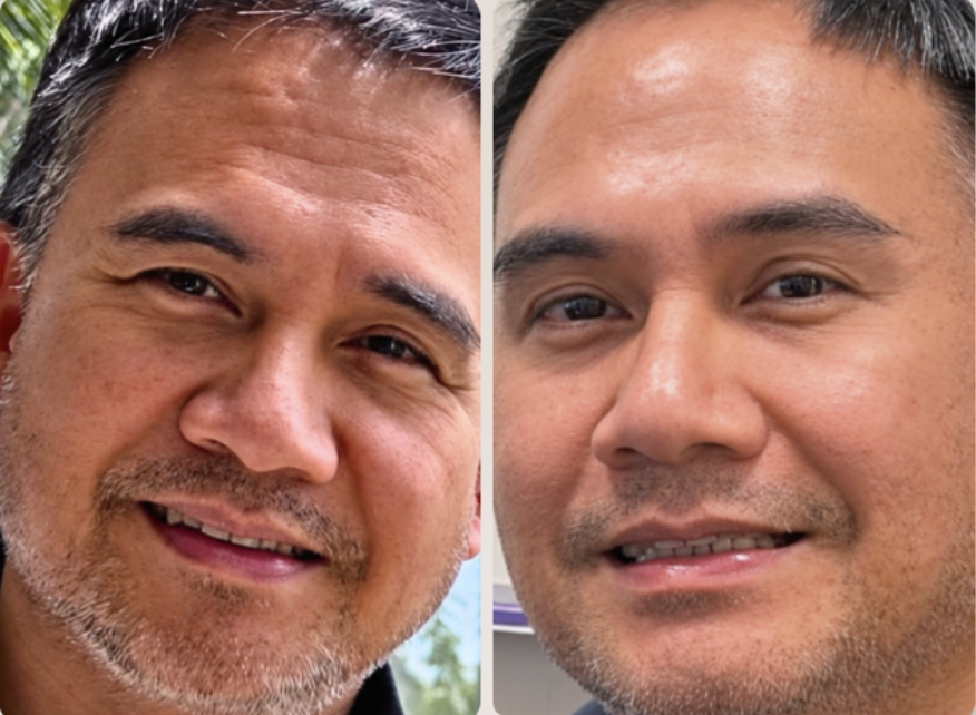 Two side-by-side photographs supplied by ELIXIA for the Botox After 5 PM promotion